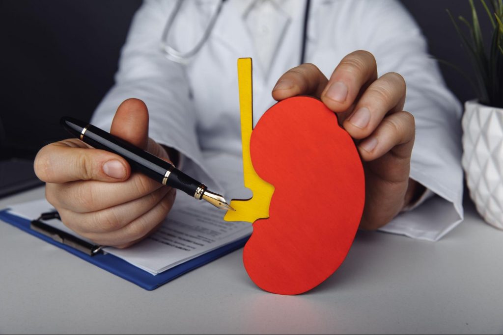 a doctor with a model of a kidney to represent Why You May be Referred to a Nephrologist