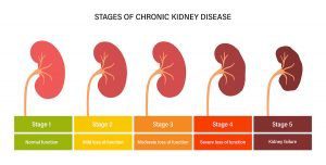 stages of kidney disease