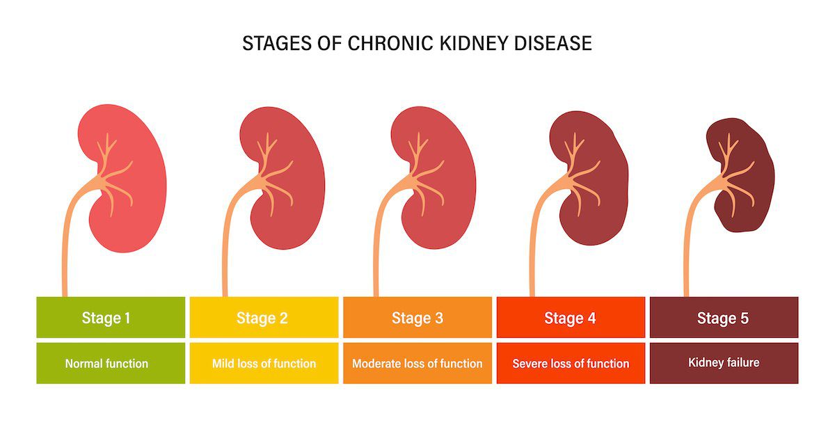 new research into kidney disease